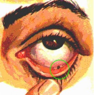 Resultado de imagem para cisco no olho